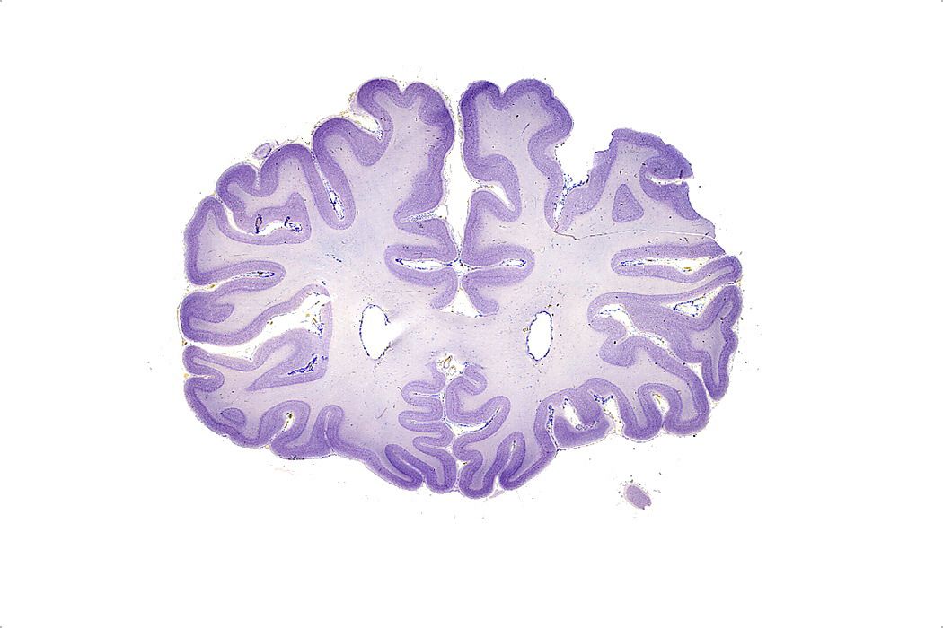 Human Forebrain