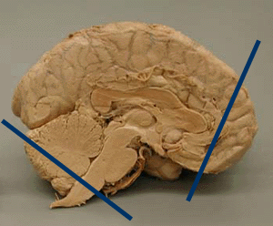 Human Sagittal View