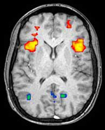 fMRI scan