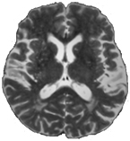 MRI horizontal slice