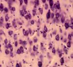 20x Photomicrograph Cat Forebrain