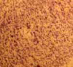 4x Photomicrograph Monkey Forebrain