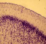 4x Photomicrograph Rat Forebrain