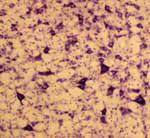 10x Photomicrograph Rat Hindbrain