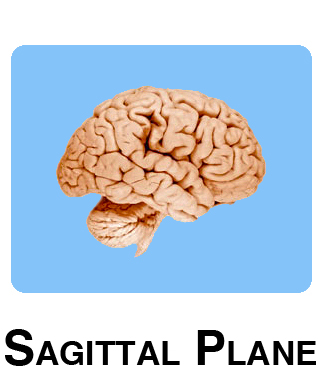 Sagittal Plane