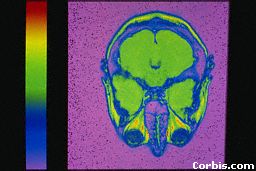 brainscan2.jpg (11750 bytes)